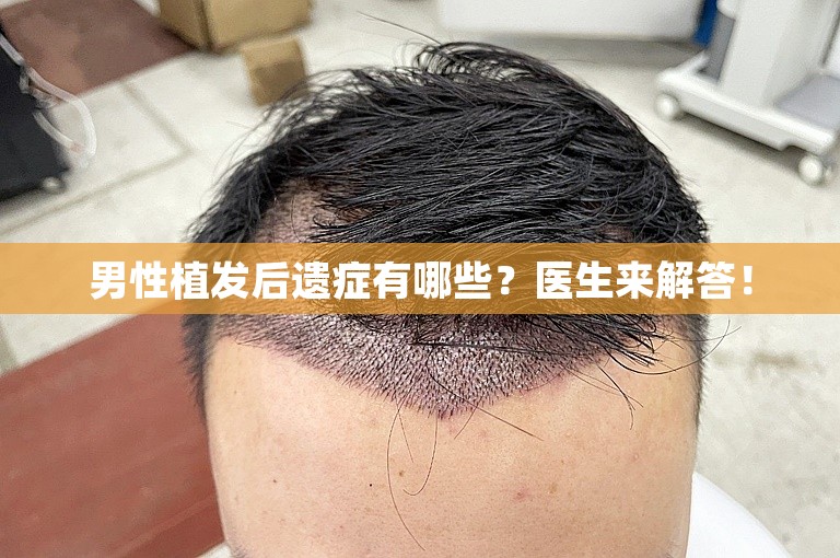 男性植发后遗症有哪些？医生来解答！