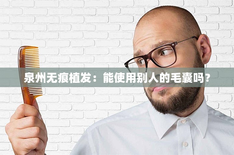 泉州无痕植发：能使用别人的毛囊吗？