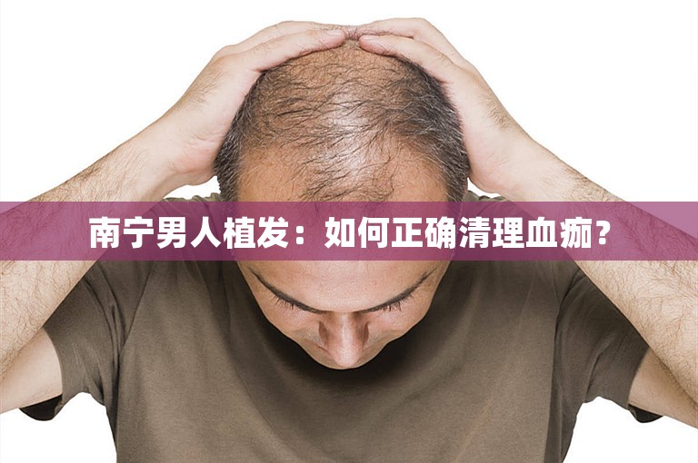 南宁男人植发：如何正确清理血痂？