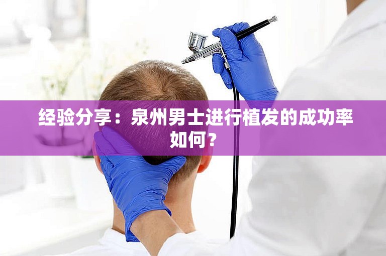  经验分享：泉州男士进行植发的成功率如何？