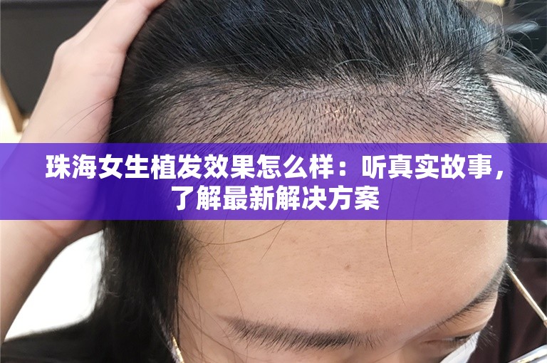 珠海女生植发效果怎么样：听真实故事，了解最新解决方案