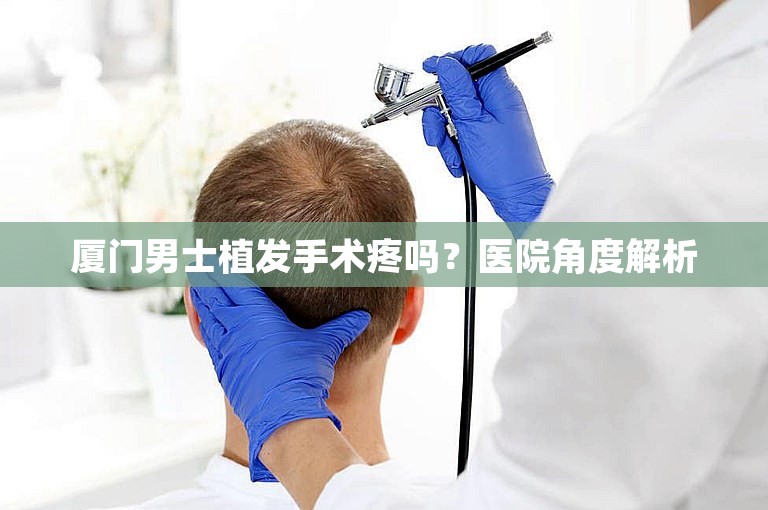 厦门男士植发手术疼吗？医院角度解析