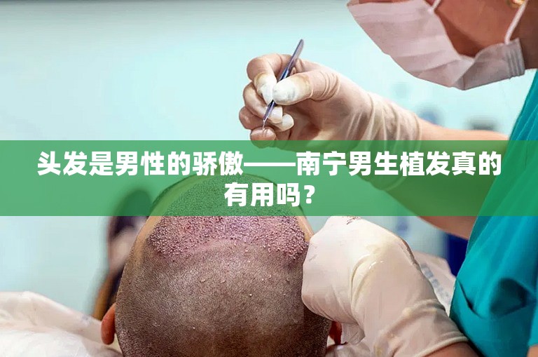 头发是男性的骄傲——南宁男生植发真的有用吗？