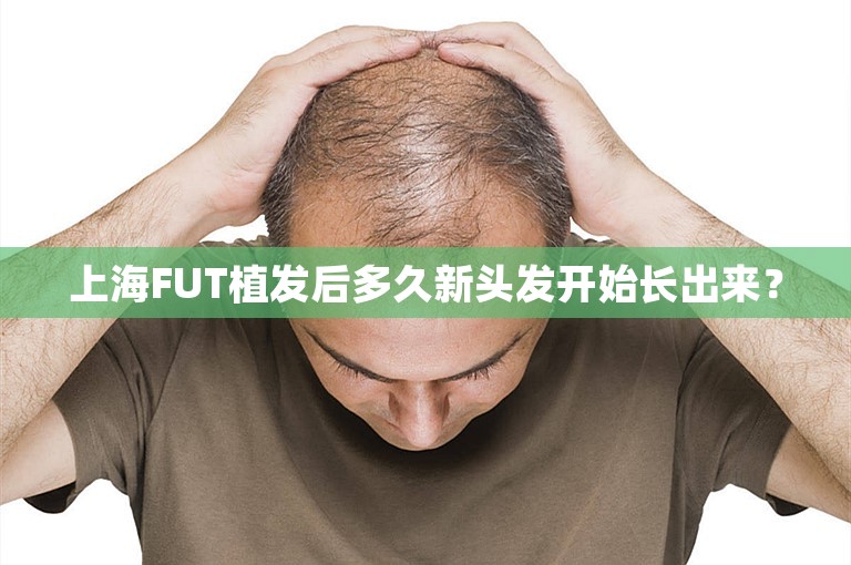 上海FUT植发后多久新头发开始长出来？