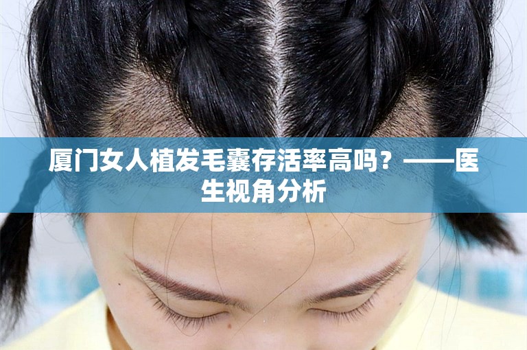 厦门女人植发毛囊存活率高吗？——医生视角分析