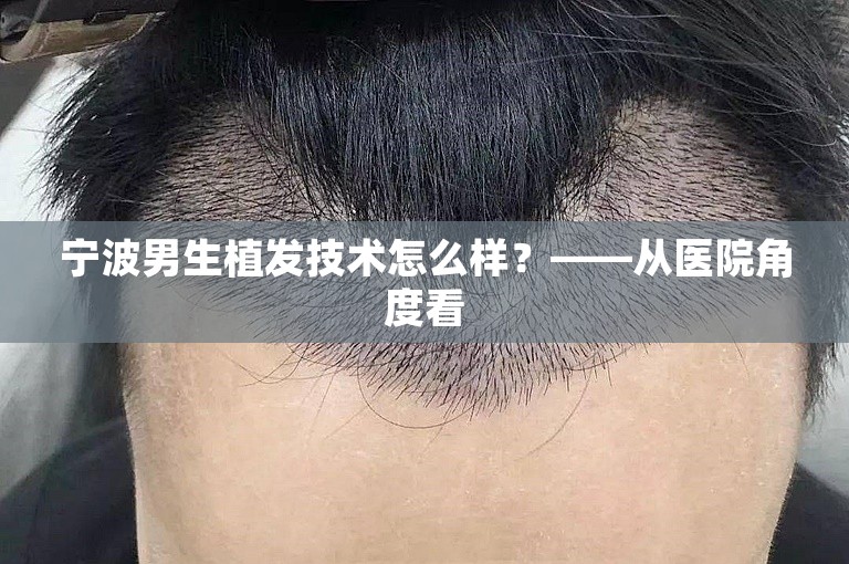 宁波男生植发技术怎么样？——从医院角度看