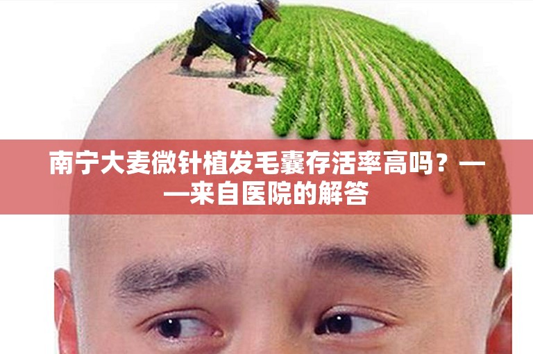 南宁大麦微针植发毛囊存活率高吗？——来自医院的解答