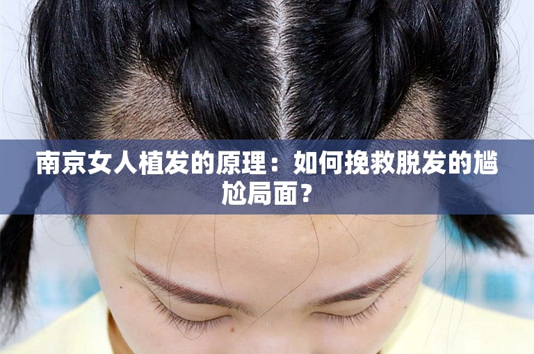 南京女人植发的原理：如何挽救脱发的尴尬局面？