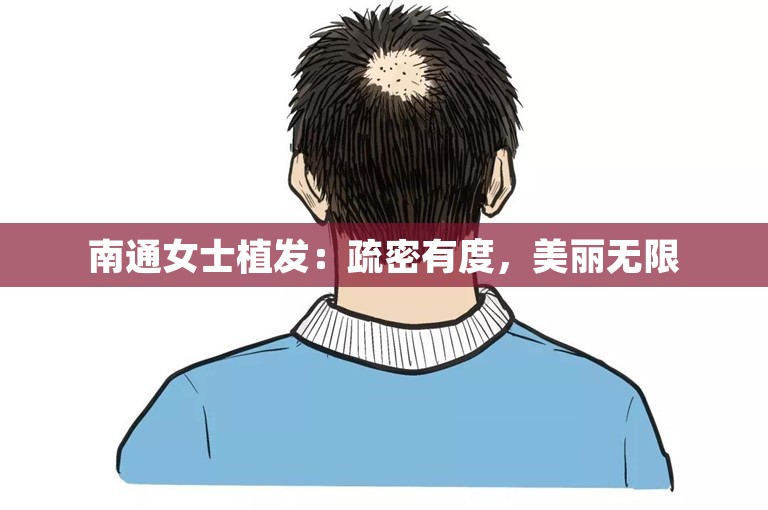 南通女士植发：疏密有度，美丽无限