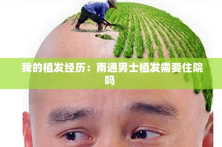  我的植发经历：南通男士植发需要住院吗 