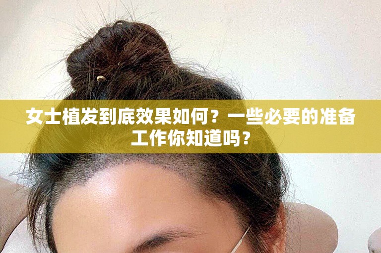 女士植发到底效果如何？一些必要的准备工作你知道吗？