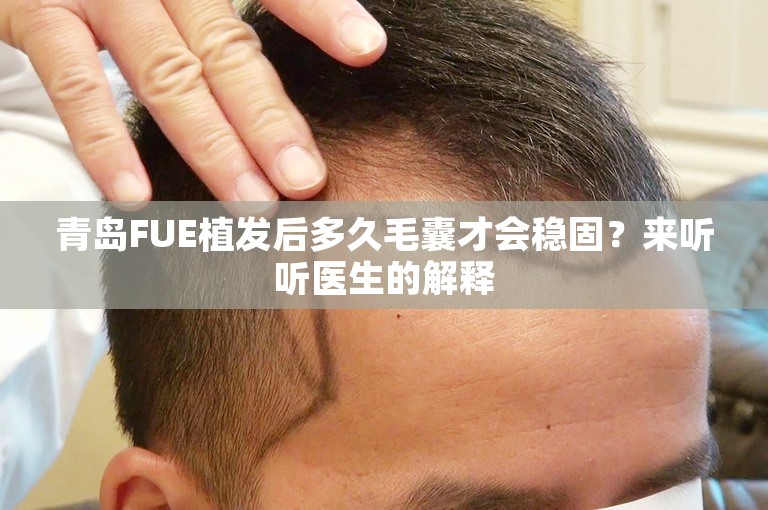 青岛FUE植发后多久毛囊才会稳固？来听听医生的解释