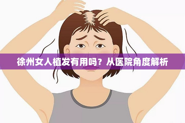 徐州女人植发有用吗？从医院角度解析