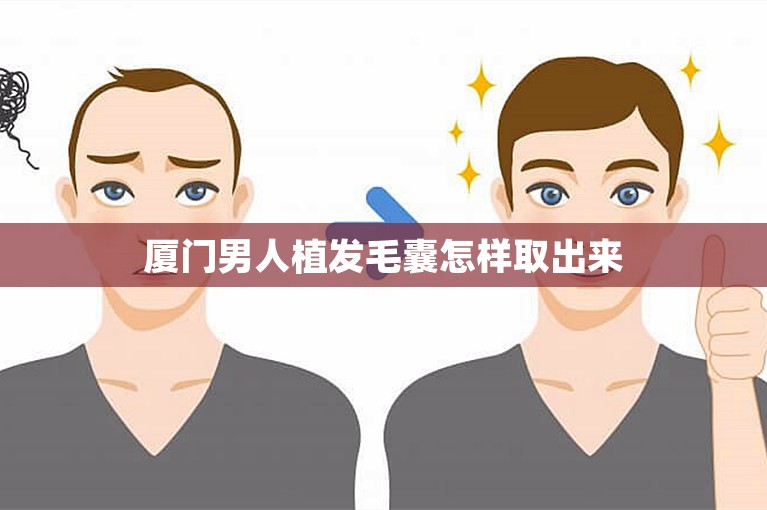 厦门男人植发毛囊怎样取出来