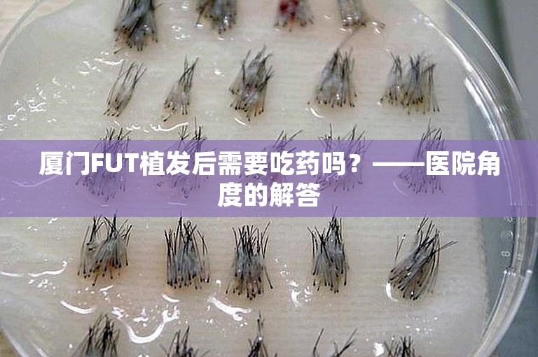 厦门FUT植发后需要吃药吗？——医院角度的解答