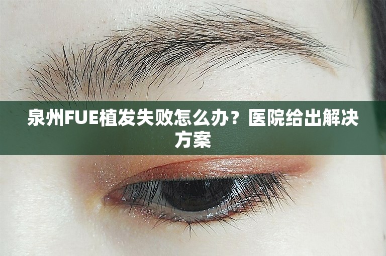 泉州FUE植发失败怎么办？医院给出解决方案