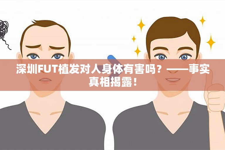 深圳FUT植发对人身体有害吗？——事实真相揭露！