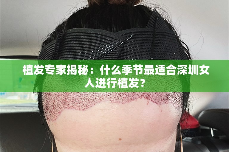  植发专家揭秘：什么季节最适合深圳女人进行植发？