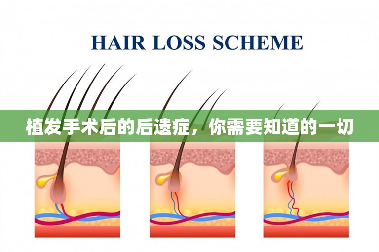 植发手术后的后遗症，你需要知道的一切