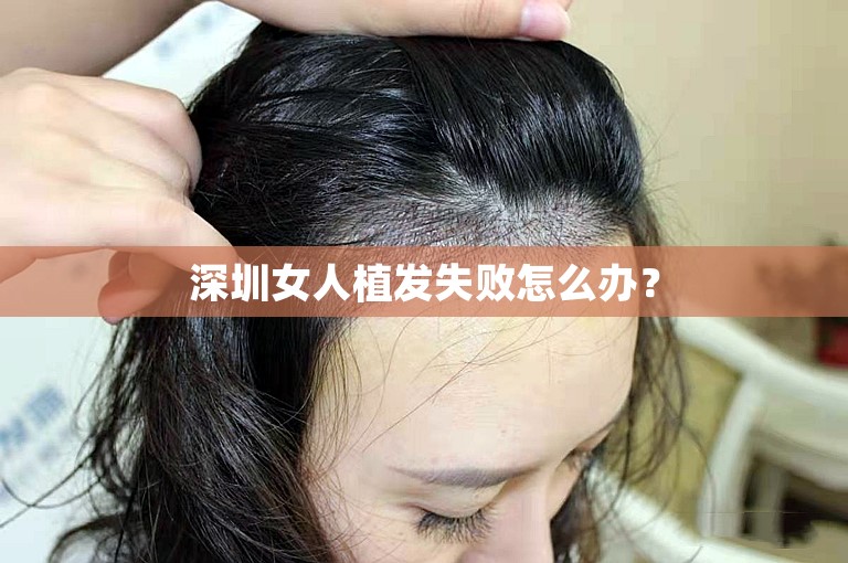 深圳女人植发失败怎么办？