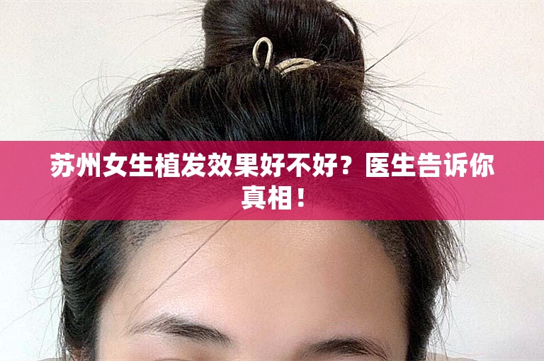 苏州女生植发效果好不好？医生告诉你真相！