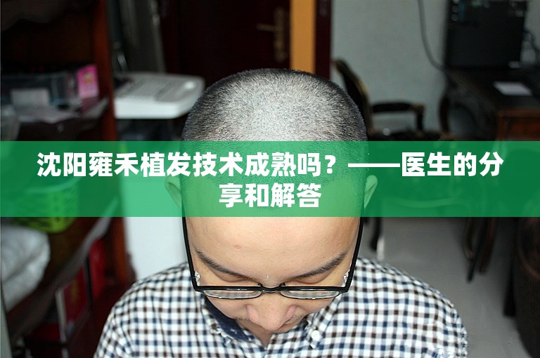 沈阳雍禾植发技术成熟吗？——医生的分享和解答