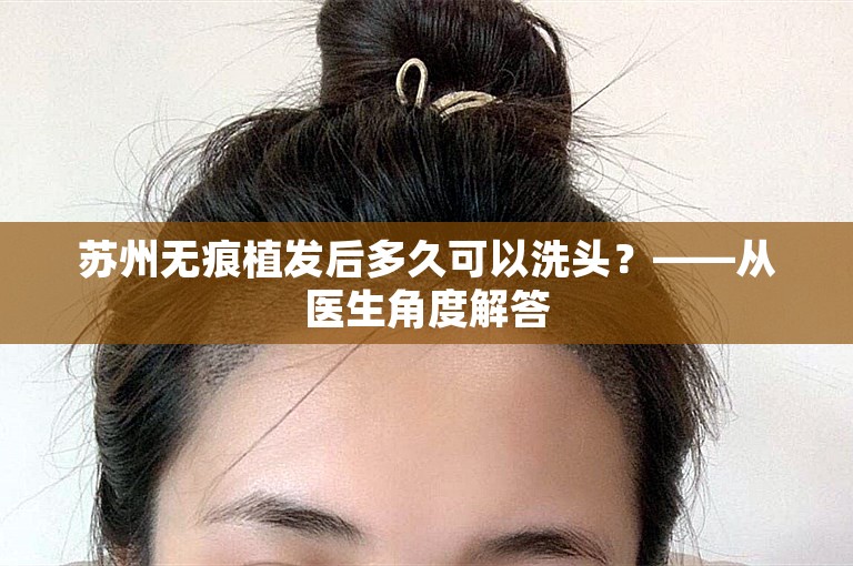 苏州无痕植发后多久可以洗头？——从医生角度解答