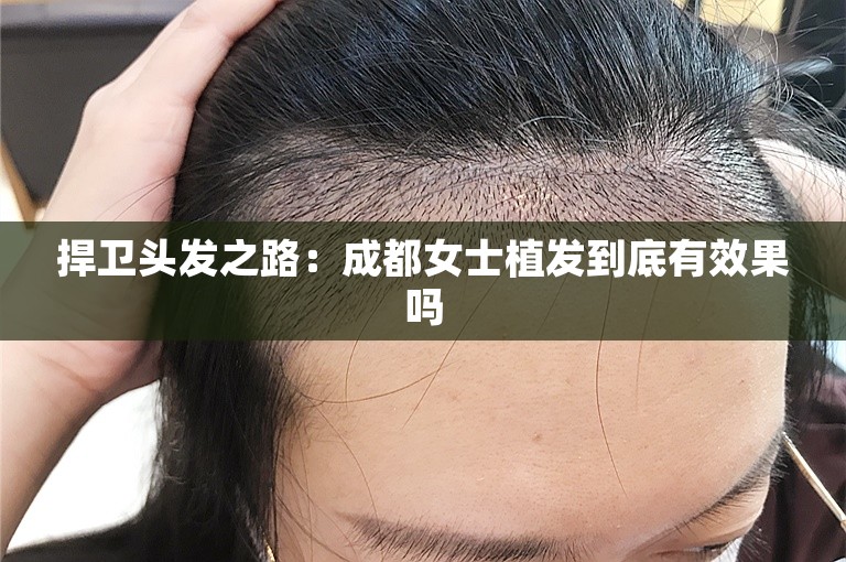 捍卫头发之路：成都女士植发到底有效果吗