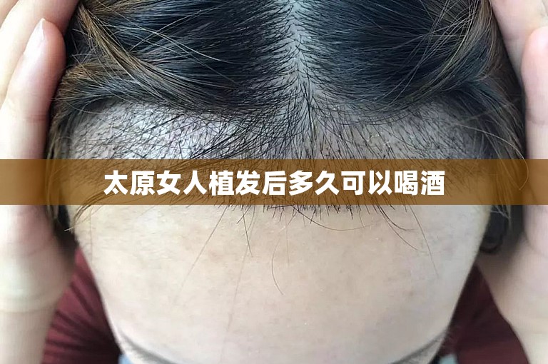 太原女人植发后多久可以喝酒