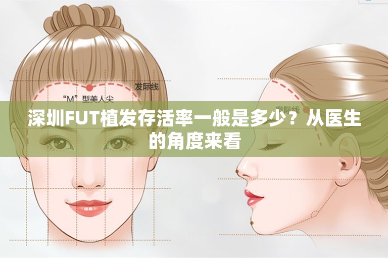 深圳FUT植发存活率一般是多少？从医生的角度来看