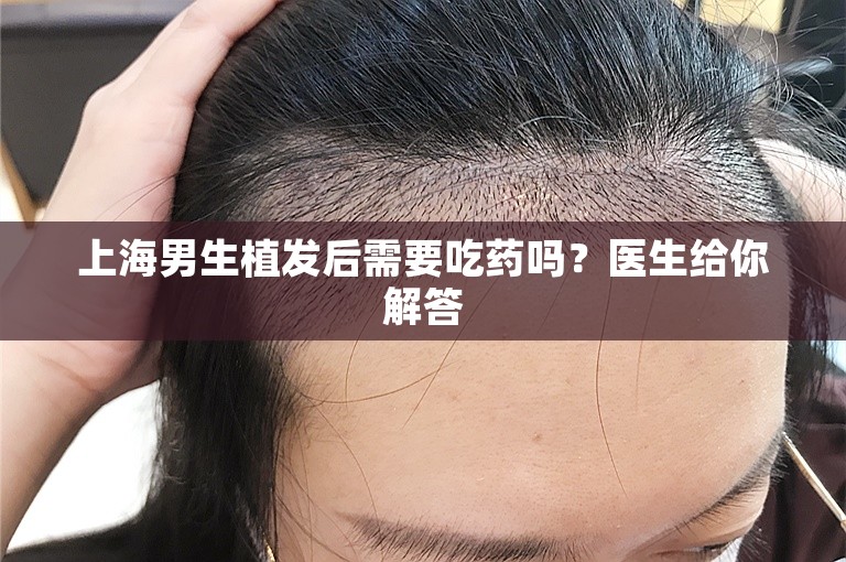 上海男生植发后需要吃药吗？医生给你解答