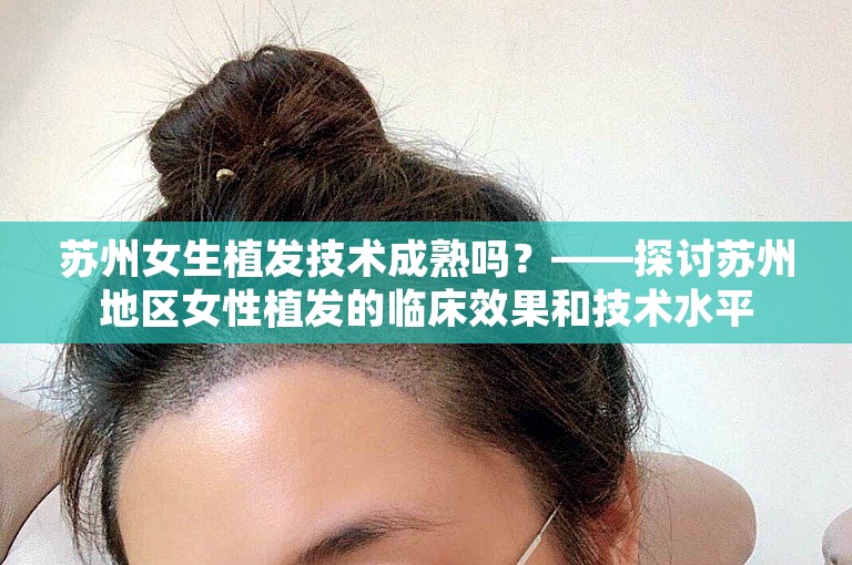 苏州女生植发技术成熟吗？——探讨苏州地区女性植发的临床效果和技术水平