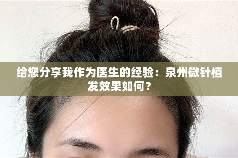 给您分享我作为医生的经验：泉州微针植发效果如何？