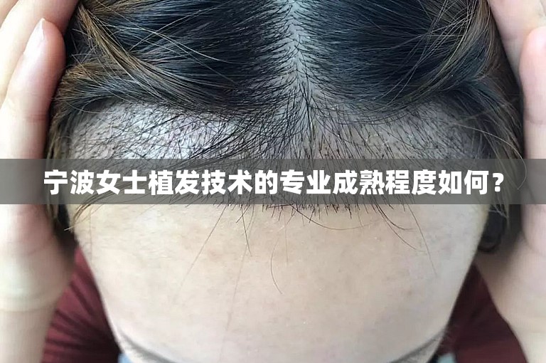 宁波女士植发技术的专业成熟程度如何？