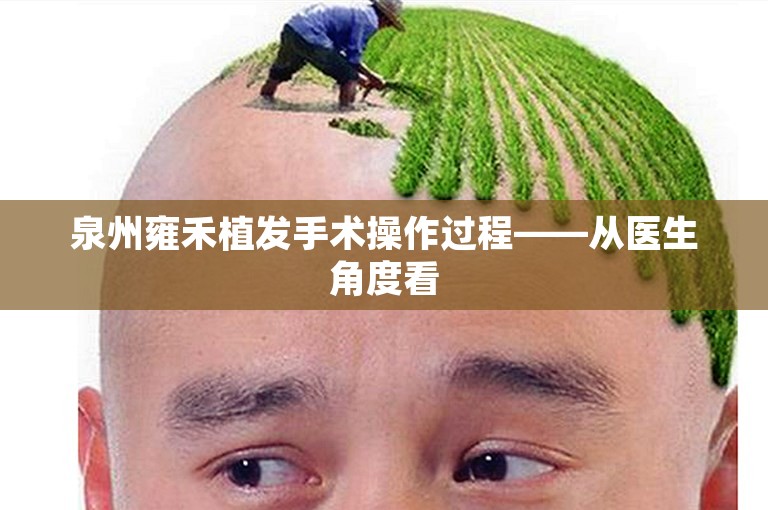 泉州雍禾植发手术操作过程——从医生角度看