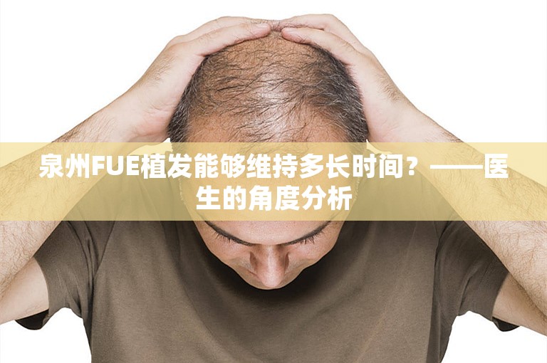 泉州FUE植发能够维持多长时间？——医生的角度分析