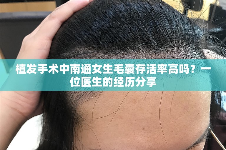 植发手术中南通女生毛囊存活率高吗？一位医生的经历分享