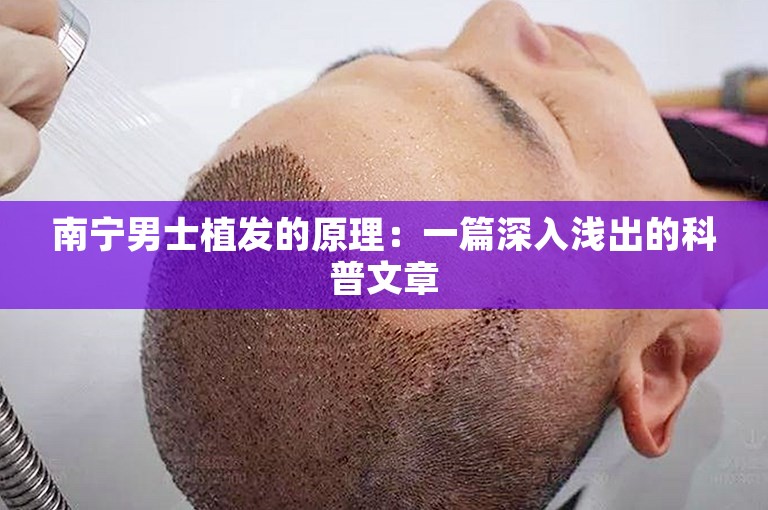 南宁男士植发的原理：一篇深入浅出的科普文章