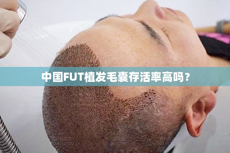 中国FUT植发毛囊存活率高吗？