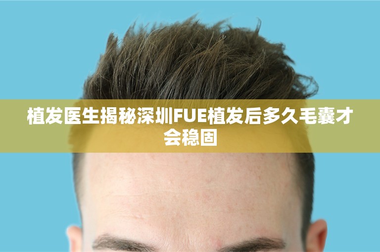 植发医生揭秘深圳FUE植发后多久毛囊才会稳固