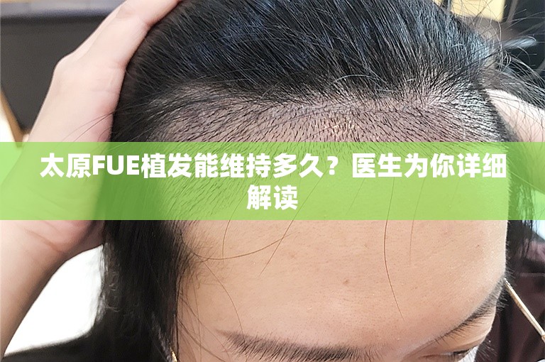 太原FUE植发能维持多久？医生为你详细解读