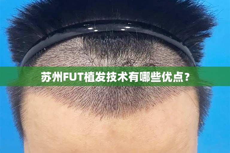 苏州FUT植发技术有哪些优点？