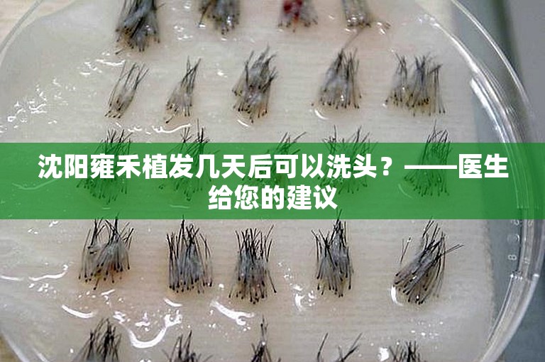 沈阳雍禾植发几天后可以洗头？——医生给您的建议