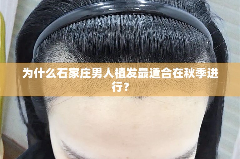 为什么石家庄男人植发最适合在秋季进行？