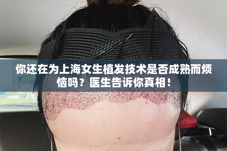 你还在为上海女生植发技术是否成熟而烦恼吗？医生告诉你真相！