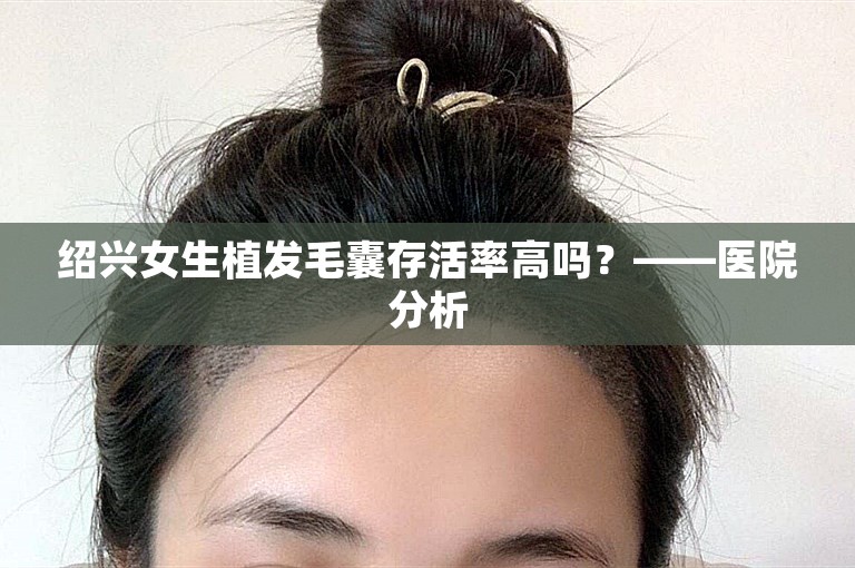 绍兴女生植发毛囊存活率高吗？——医院分析