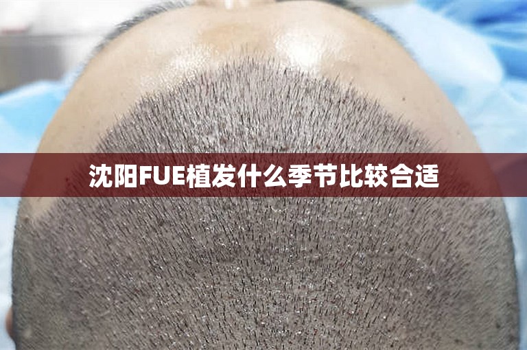 沈阳FUE植发什么季节比较合适