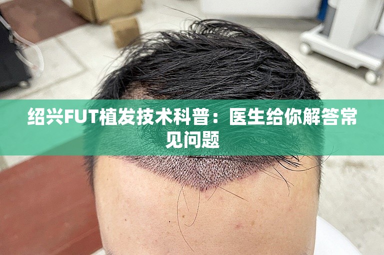 绍兴FUT植发技术科普：医生给你解答常见问题