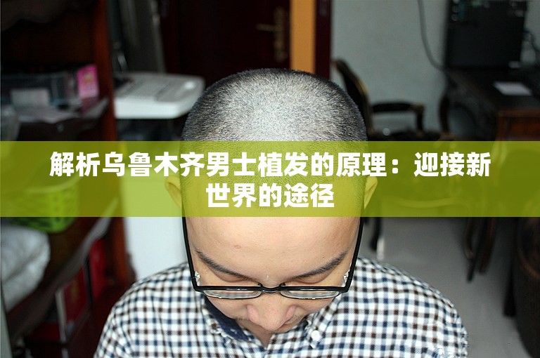 解析乌鲁木齐男士植发的原理：迎接新世界的途径