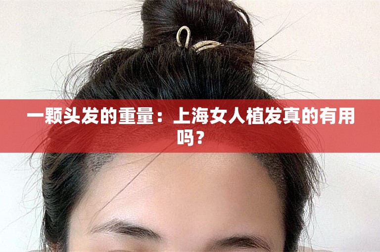 一颗头发的重量：上海女人植发真的有用吗？